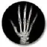 bonehand